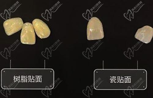 樹脂貼面和瓷貼面的區(qū)別