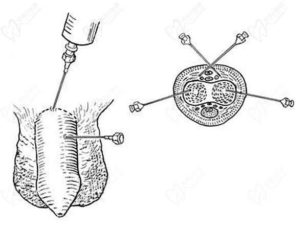 重慶星榮整形外科醫(yī)院男科手術優(yōu)勢