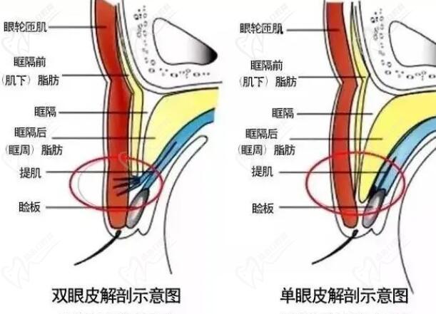 杜圓圓修復(fù)雙眼皮水平怎么樣