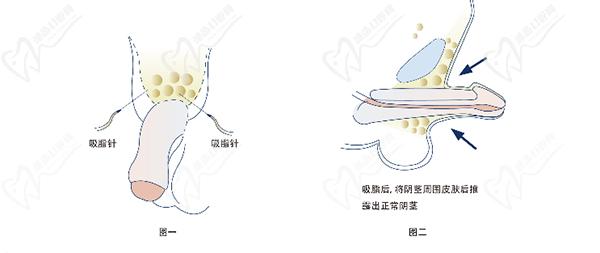 星榮李世榮醫(yī)生費(fèi)用