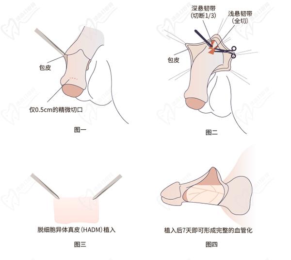 李世榮醫(yī)生做男科手術(shù)怎么樣