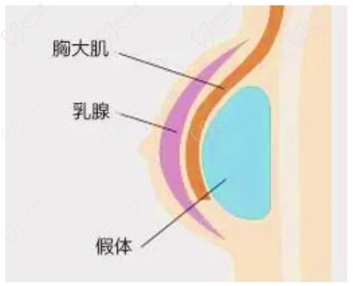 米蘭柏羽開啟胸部醫(yī)生面診日，穆大力、李英大親診做出精致自然美胸